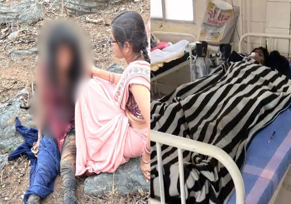 दर्द से कराहती जंगल में मिली युवती, गैंगरेप कर मृत समझकर फरार हुए आरोपी... प्राइवेट पार्टी व शरीर पर कई जगह चोटों के निशान