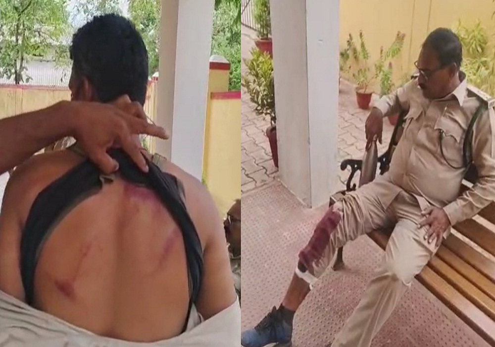 ग्रामीणों ने वन विभाग की टीम पर बरसाए लाठी-डंडे, डिप्टी रेंजर समेत 4 घायल