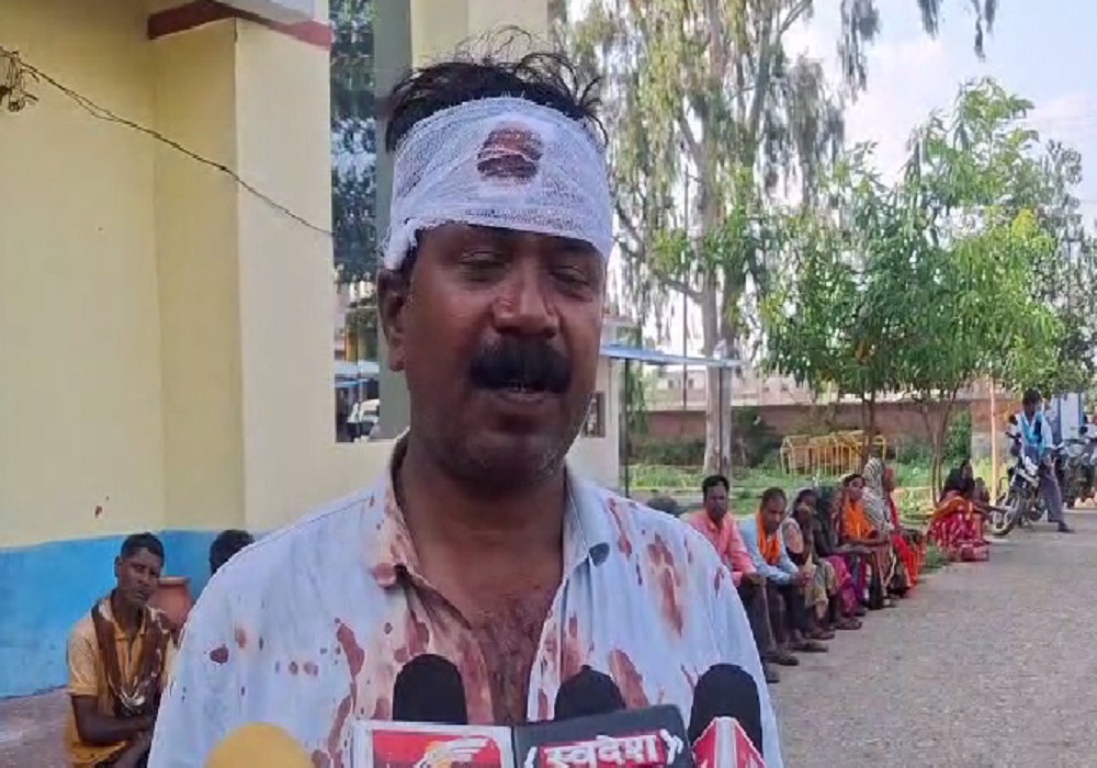 Amera Coal Mine: ग्रामीणों के हमले में घायल हुआ खनन उप प्रबंधक, थाने में दर्ज कराई रिपोर्ट